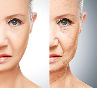 Gençlik Aşısı (Antiaging Mezoterapisi).